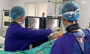 Khỏi zona cả năm vẫn bị những cơn đau như điện giật hành hạ